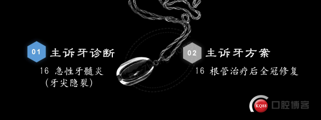 腔中石，去与留-右上第一磨牙隐裂所致牙髓炎-Dr. Zhong Hong_06(1).jpg