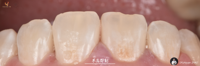 赵医生的病例整理集.006.jpeg