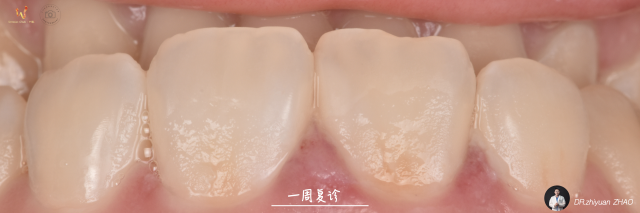 赵医生的病例整理集.007.jpeg