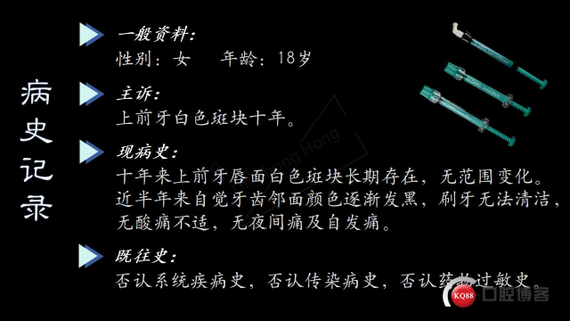 前牙白色斑块修复的 “黄金搭档”— ICON 渗透树脂联合微研磨— Dr. Zhong Hong_02.jpg