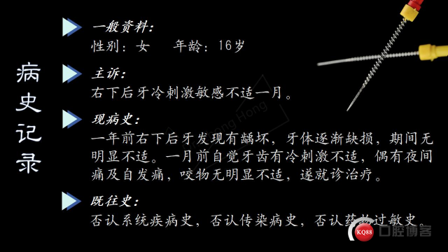 右下前磨牙1-2型根管治疗后树脂注塑充填的离体牙观察-Dr. Zhong Hong_02.jpg