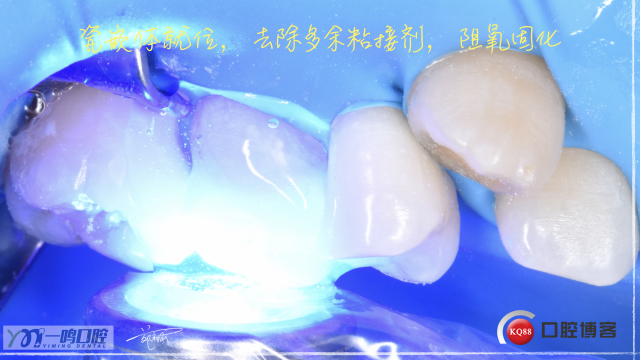 15:嵌体16:9.014.jpeg