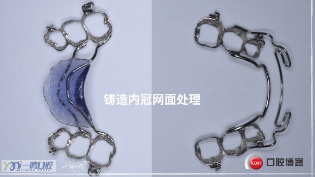 正畸16:9.007.jpeg
