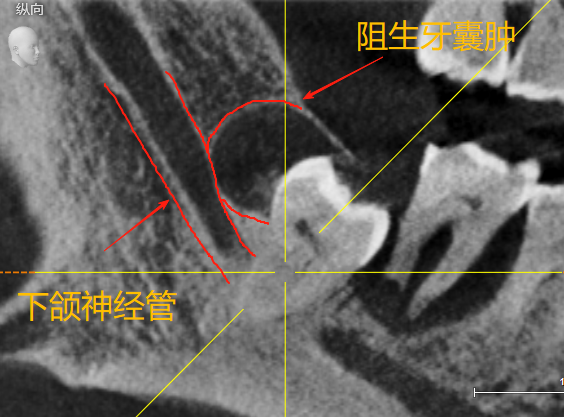 1755508587_957804.bmp