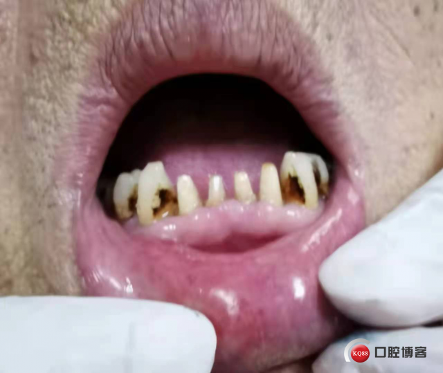 1761227268_326344.jpg 老王1.jpg