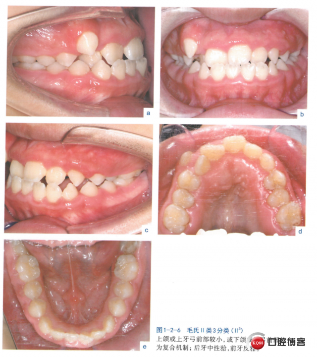 dd9192a1efdea03fcf541d82a670cc01.png