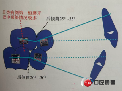 36bbefd705a578d0c5e8ff6af4cbc443.png