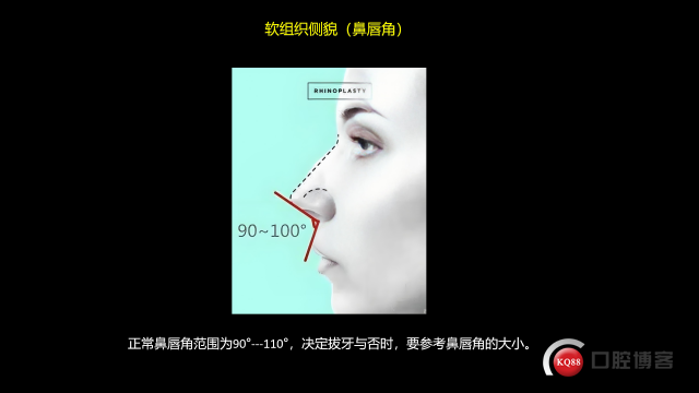 34.png