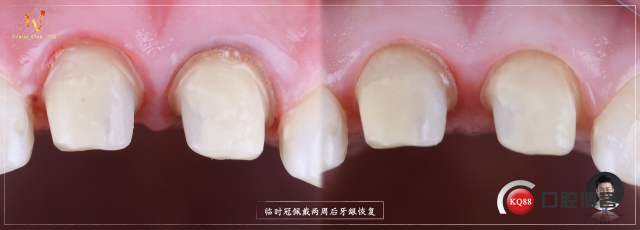 1768208101_603417.jpeg 修复全流程.012.jpeg
